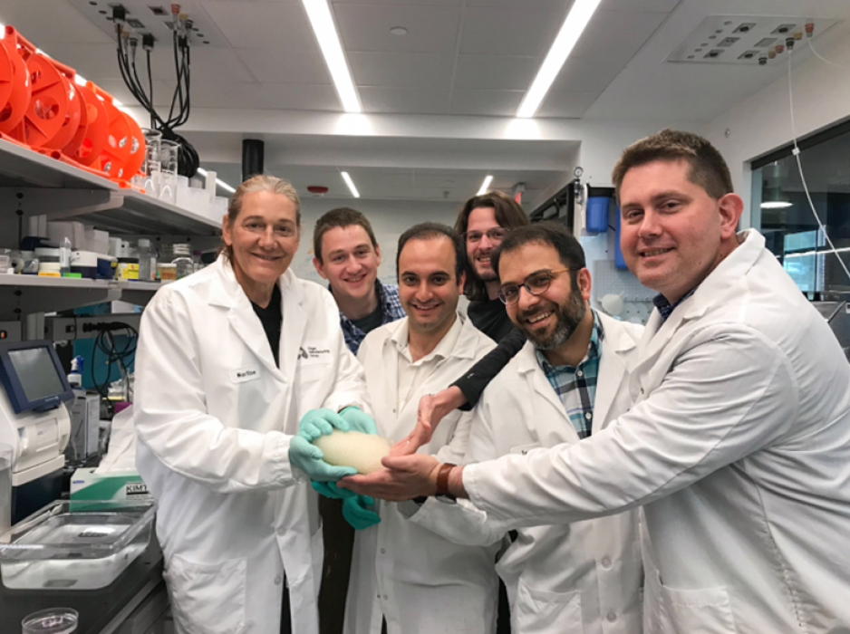 Rothblatt, left, and the team at United Therapeutics’ Organ Manufacturing Group in Manchester, N.H., holding a lung they are able to 3D-print from human collagen fiber grown in genetically modified tobacco plants with the help of Texas A&M University (Photo Courtesy of United Therapeutics).